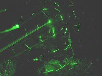Hughs laser lights at closing party